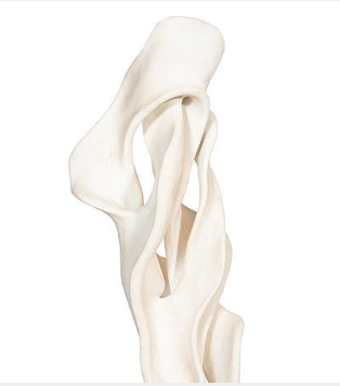 Cast Dancing Sculpture, Coupé, Faux Bleached